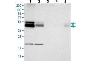 Western blot analysis of Lane 1: RT-4, Lane 2: U-251 MG, Lane 3: Human Plasma, Lane 4: Liver, Lane 5: Tonsil with BNIP2 polyclonal antibody .