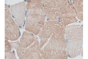 Detection of MYO1D in Rat Skeletal muscle Tissue using Polyclonal Antibody to Myosin ID (MYO1D) (Myosin ID anticorps  (AA 512-788))