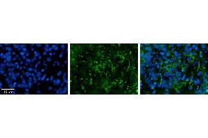 Rabbit Anti-ZDHHC17 Antibody     Formalin Fixed Paraffin Embedded Tissue: Human Pineal Tissue  Observed Staining: Cytoplasmic in vesicles and processes of pinealocytes  Primary Antibody Concentration: 1:100  Secondary Antibody: Donkey anti-Rabbit-Cy3  Secondary Antibody Concentration: 1:200  Magnification: 20X  Exposure Time: 0. (ZDHHC17 anticorps  (Middle Region))