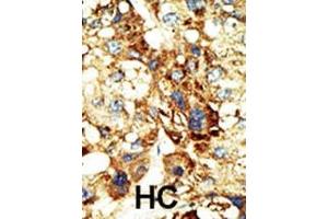 anti-DNA (Cytosine-5-)-Methyltransferase 3 alpha (DNMT3A) (AA 457-486) antibody