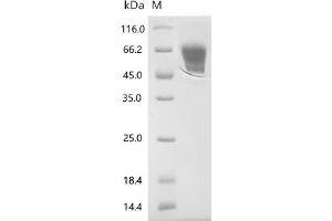 (Tris-Glycine gel) Discontinuous SDS-PAGE (reduced) with 5 % enrichment gel and 15 % separation gel.