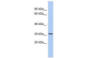 WB Suggested Anti-CACNG6 Antibody Titration:  0. (CACNG6 anticorps  (N-Term))
