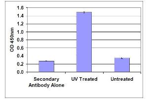 DNA Damage Induced by UV Light in HeLa Cells.