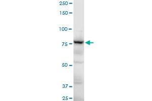ADD3 polyclonal antibody (A01), Lot # CHI0060725QCS1.