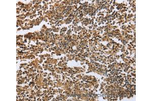 Immunohistochemistry of Human tonsil using ECE1 Polyclonal Antibody at dilution of 1:60 (ECE1 anticorps)