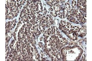 Image no. 5 for anti-V-Ets Erythroblastosis Virus E26 Oncogene Homolog 2 (ETS2) (AA 90-349) antibody (ABIN1491703) (ETS2 anticorps  (AA 90-349))