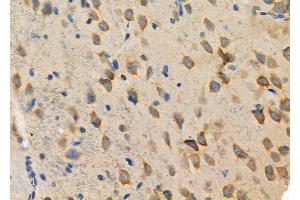 ABIN6264002 and ABIN6277554 at 1/100 staining Rat brain tissue by IHC-P.