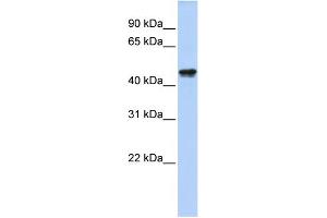 WB Suggested Anti-QTRTD1 Antibody Titration:  0. (QTRTD1 anticorps  (N-Term))