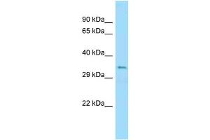 WB Suggested Anti-Ubb Antibody Titration: 1.