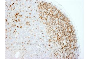 Immunohistochemistry (IHC) image for anti-Antigen Identified By Monoclonal Antibody Ki-67 (MKI67) (AA 1650-1700) antibody (ABIN7448620)