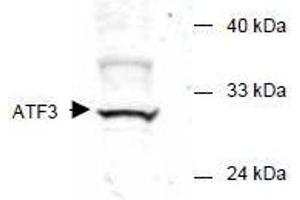 Image no. 1 for anti-Activating Transcription Factor 3 (ATF3) (AA 113-130) antibody (ABIN401262) (ATF3 anticorps  (AA 113-130))