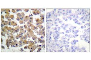 Immunohistochemistry (IHC) image for anti-Transforming Growth Factor, beta 1 (TGFB1) (C-Term) antibody (ABIN1848794) (TGFB1 anticorps  (C-Term))