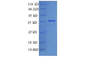 30S Ribosomal Protein S18 (AA 2-75), (full length) protein (GST tag)