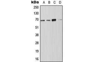 Western blot analysis of NOX4 expression in JAR (A), Jurkat (B), SP2/0 (C), PC12 (D) whole cell lysates. (NADPH Oxidase 4 anticorps  (N-Term))