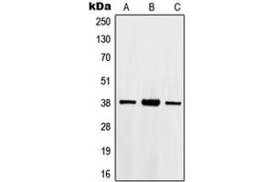 Western blot analysis of HOXB2 expression in Jurkat (A), HepG2 (B), A549 (C) whole cell lysates. (HOXB2 anticorps  (Center))