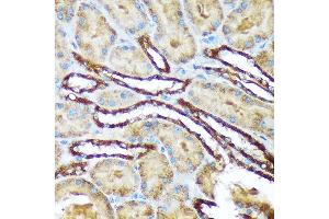 Immunohistochemistry of paraffin-embedded rat kidney using Versican Rabbit mAb (ABIN7271309) at dilution of 1:100 (40x lens).