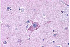 Anti-NPY5R antibody  ABIN1049125 IHC staining of human brain, neurons and glia. (NPY5R anticorps  (Cytoplasmic Domain))