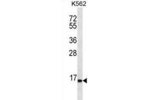 Western Blotting (WB) image for anti-Serine Peptidase Inhibitor, Kazal Type 8 (SPINK8) antibody (ABIN2996842) (SPINK8 anticorps)