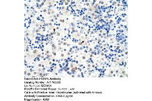 Rabbit Anti-HNRPL Antibody  Paraffin Embedded Tissue: Human Liver Cellular Data: Hepatocytes Antibody Concentration: 4.