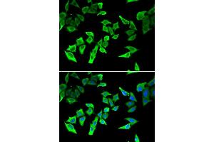 Immunofluorescence analysis of U2OS cell using MLH1 antibody. (MLH1 anticorps)