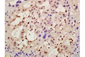 Formalin-fixed and paraffin embedded mouse placenta labeled with Rabbit Anti-AMIGO2 Polyclonal Antibody, Unconjugated (ABIN1386548) at 1:200 followed by conjugation to the secondary antibody and DAB staining (AMIGO2 anticorps  (AA 21-120))