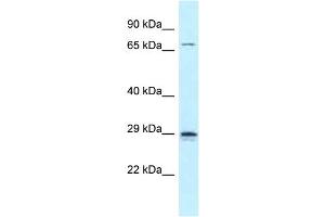 WB Suggested Anti-Neurog2 Antibody Titration: 1. (Neurogenin 2 anticorps  (C-Term))