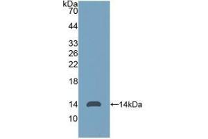 WB of Protein Standard: different control antibodies against Highly purified E.