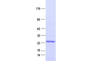 Validation with Western Blot