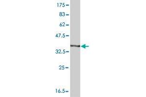 Western Blot detection against Immunogen (37.