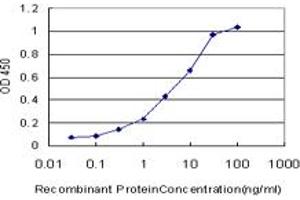 Detection limit for recombinant GST tagged PSPH is approximately 0.