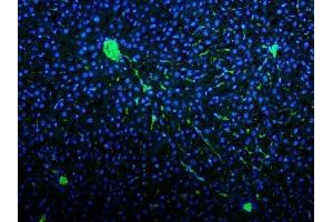 IF analysis of VWF using anti-VWF antibody (ABIN3042349). (VWF anticorps  (AA 1304-1452))
