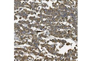 IHC analysis of ALDH1L1 using anti-ALDH1L1 antibody (ABIN7601093). (ALDH1L1 anticorps  (AA 282-424))