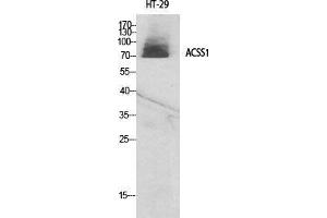 Western Blot (WB) analysis of specific cells using ACSS1 Polyclonal Antibody.