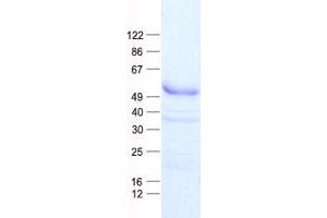 Validation with Western Blot