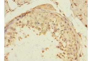 Immunohistochemistry of paraffin-embedded human testis tissue using ABIN7172192 at dilution of 1:100 (TIGD4 anticorps  (AA 301-512))