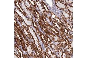Immunohistochemical staining of human kidney with PRDM12 polyclonal antibody  shows strong cytoplasmic positivity in cells in tubules at 1:10-1:20 dilution. (PRDM12 anticorps)