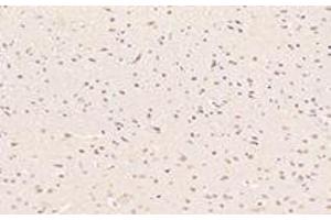 Immunohistochemistry analysis of paraffin-embedded rat substantia nigra using PARIS (ABIN7076272) at dilution of 1: 3000
