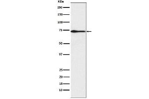 Western blot analysis of PROS1 expression in Human plasma lysate.