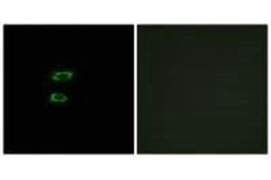 Immunofluorescence analysis of A549 cells, using BMP8A antibody. (BMP8A anticorps  (C-Term))