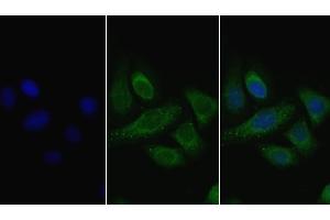 Detection of LPL in Human Hela cell using Polyclonal Antibody to Lipoprotein lipase (LPL) (Lipoprotein Lipase anticorps  (AA 28-474))