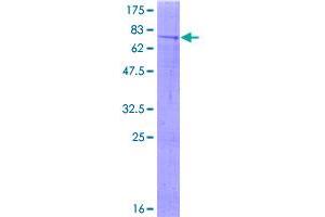 Image no. 1 for Methyltransferase Like 4 (METTL4) (AA 1-472) protein (GST tag) (ABIN1310762)