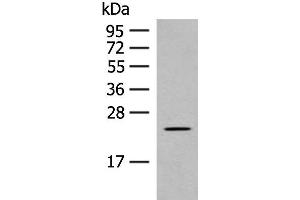 Western blot analysis of Rat heart tissue lysate using CLEC3B Polyclonal Antibody at dilution of 1:650 (CLEC3B anticorps)