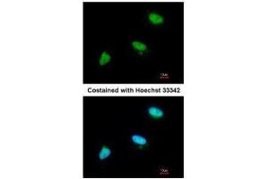 ICC/IF Image Immunofluorescence analysis of paraformaldehyde-fixed A549, using CDC34, antibody at 1:200 dilution. (CDC34 anticorps)