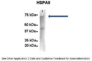 Amount and Sample Type :  500 ug mouse brain homogenate  Amount of IP Antibody :  6 ug  Primary Antibody :  HSPA9  Primary Antibody Dilution :  1:500  Secondary Antibody :  Goat anti-rabbit Alexa-Fluor 594  Secondary Antibody Dilution :  1:5000  Gene Name :  HSPA9  Submitted by :  Dr.
