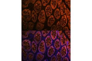 Immunofluorescence analysis of rat rectum using Galectin 4/LG Rabbit mAb (ABIN1679347, ABIN3017979, ABIN3017980 and ABIN7101554) at dilution of 1:100 (40x lens).