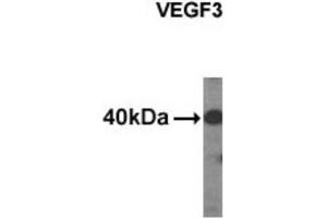 Western Blotting (WB) image for anti-Vascular Endothelial Growth Factor C (VEGFC) antibody (ABIN2995286) (VEGFC anticorps)