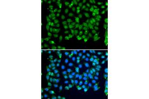 Immunofluorescence analysis of MCF-7 cells using RNF8 antibody (ABIN5974404).