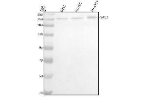 Western blot analysis of NAV3 using anti-NAV3 antibody (ABIN7602615).