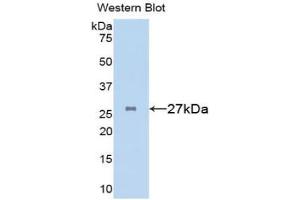 Western blot analysis of the recombinant protein. (Clusterin anticorps  (AA 227-447))