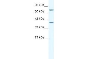 WB Suggested Anti-ZNF660 Antibody Titration:  1. (ZNF660 anticorps  (C-Term))